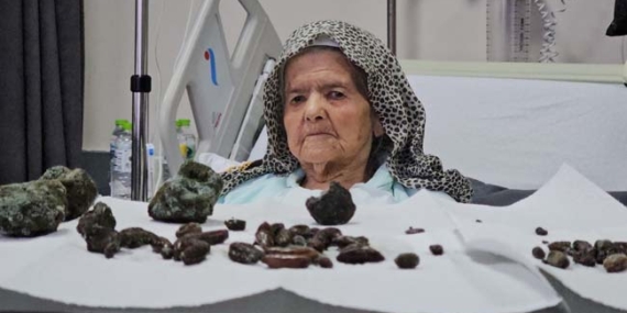 Mide ve bağırsaklarından çıkanlar şok etti